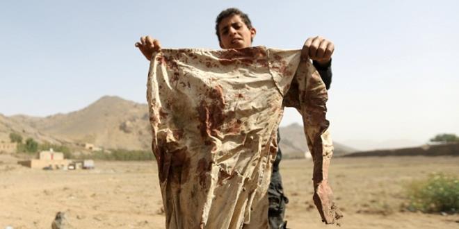 2015-04-07T111013Z_1452154820_GF10000051526_RTRMADP_3_YEMEN-SECURITY_700_450_c1