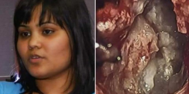 Yamini-Karanam-Womans-brain-tumor-turns-out-to-be-evil-twin-Video-660x330