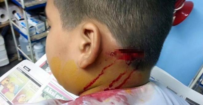 11403099_n_700_394_c1