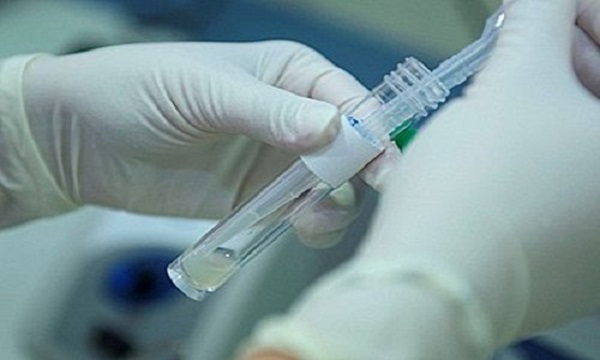 477a34dc59ff488de629f9a48cec5c23