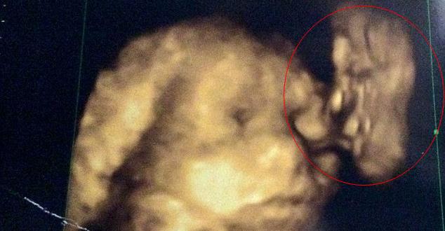 2CED9B9F00000578-3257687-image-m-19_1443797083069