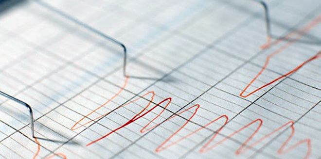 polygraph-chart