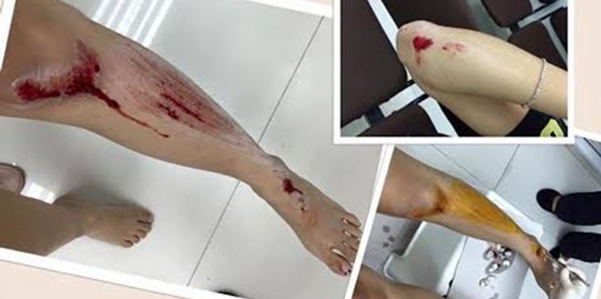 f8d67d0e-11e0-4fc3-842d-ce42f365015c_700_1049_c1