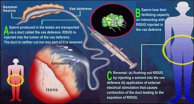 Vasalgel-Male-Birth-Control-Shot1-650x350