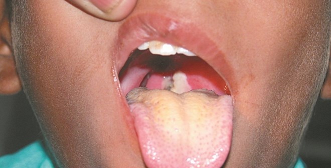 D123122341234_700_526_c1