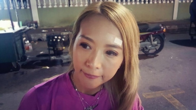 bkn-20170603223506488-0603_00862_001_06b_700_394