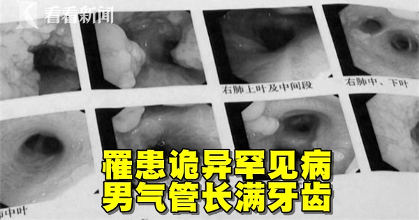 d2826317