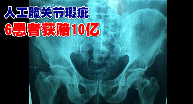 s_ac80e14d-e6d3-47c9-bb31-b01330008f32_meitu_6