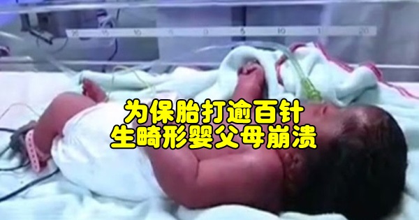 bkncn-20171201010416430-1201_05011_001_01p