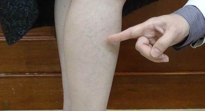 640_deeed3bec63c3a745cae604a3f18c0bf