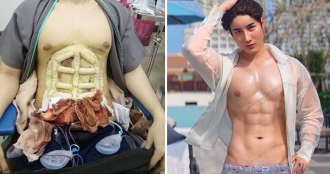 182806a8rui7brpmzpiei7