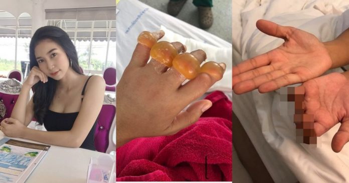 13a9fefe162546e9a0f403d708ab21b7