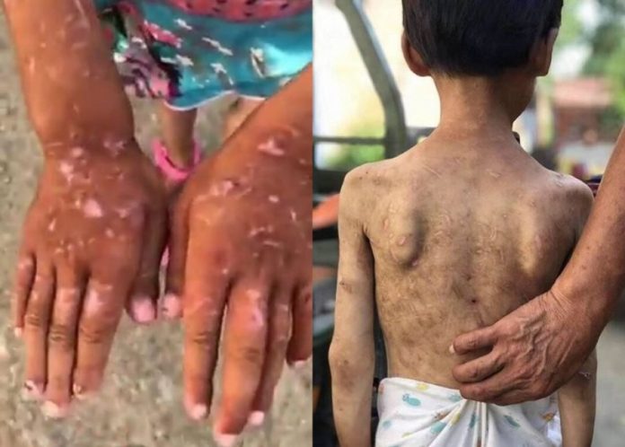 ab0f12a94e8d75a9684479a3418d302c