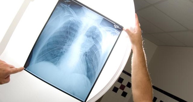 10c19720a2b5456ea7fcab7a73208309