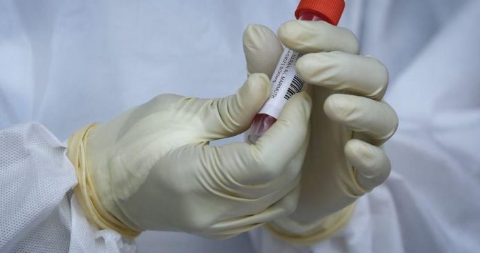 b992309d312827a3cbad0e882f57b7aa