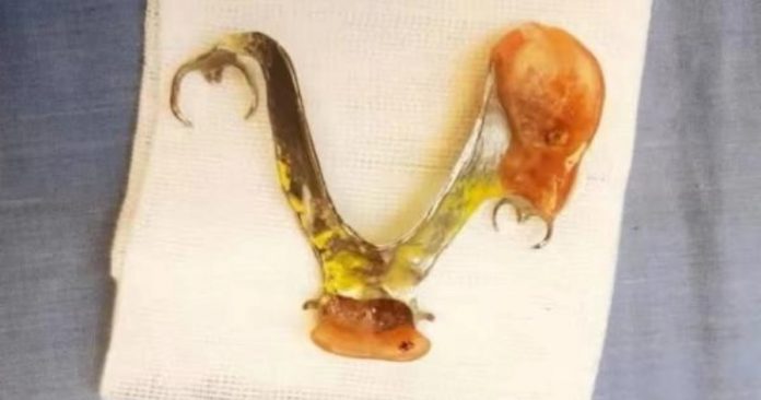 bd5a1a40a0a04e606424aeaddd14f619