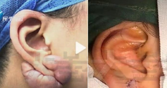 65dd96cc72f503526c1c75c940203028-side