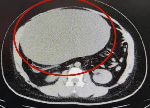 md-cb1d51065ddd570d7d752967626ea11d