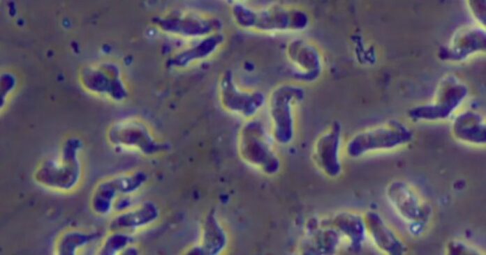 2bf7542ff116ffa53c7c75f7b4e5b91a