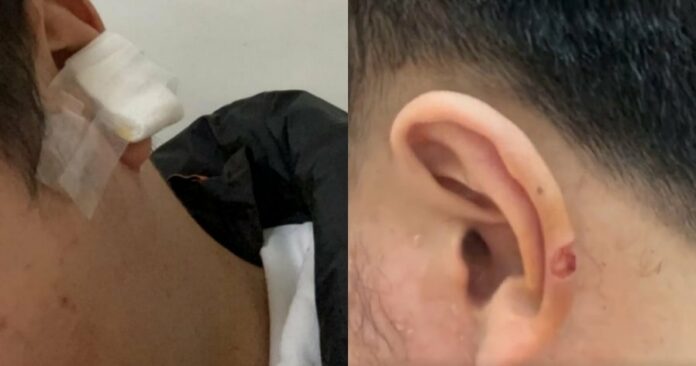 44370bdb9692a3088b2b6eaf1c5c6b91