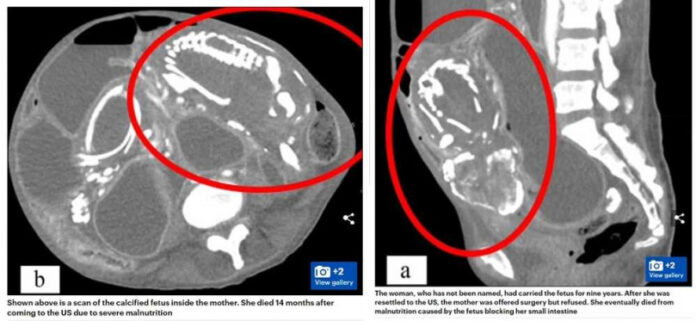 10650ffb73070df3a3e0497d14da496f