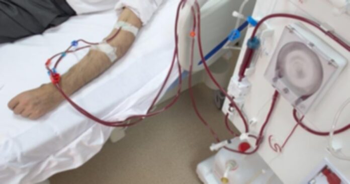 14618-dialysis-153501889