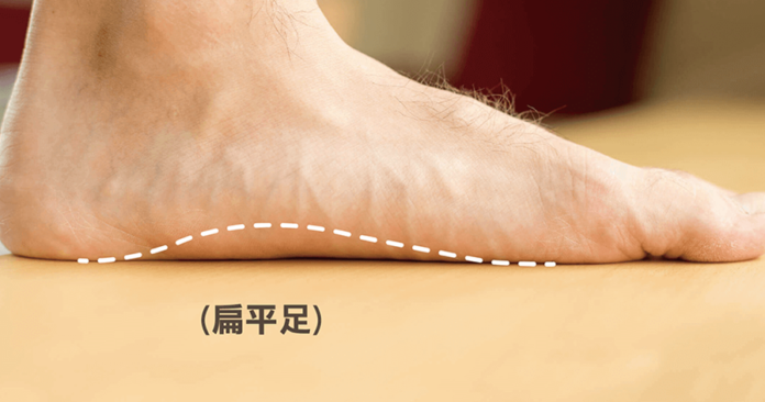 _E6_89_81_E5_B9_B3_E8_B6_B3-01