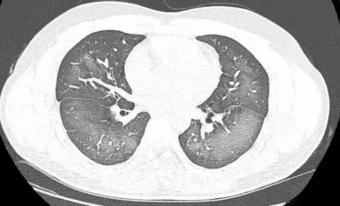 d812da679edeb749e41b26ff4596aa32